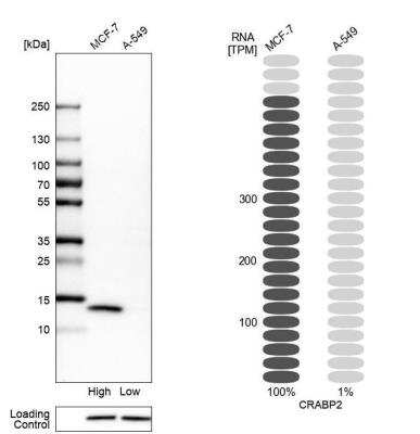 Western Blot: CRABP2 Antibody [NBP1-85465]