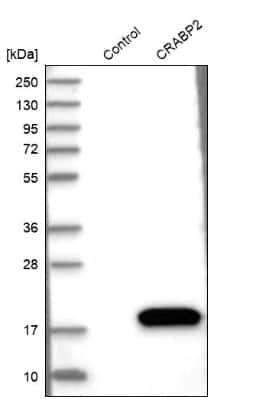 Western Blot: CRABP2 Antibody [NBP1-85465]