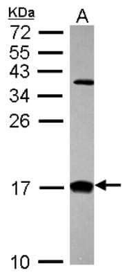 Western Blot: CRABP2 Antibody [NBP2-15998]