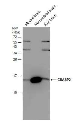 Western Blot: CRABP2 Antibody [NBP2-15998]