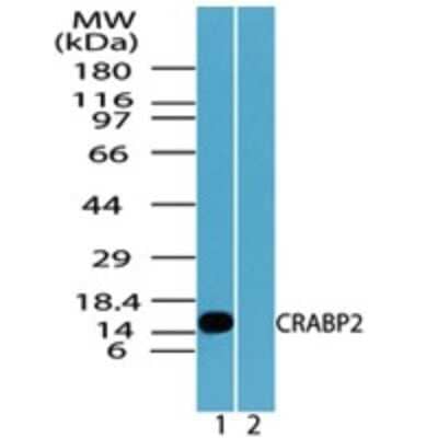 Western Blot: CRABP2 Antibody [NBP2-24764]