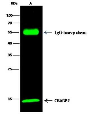 Western Blot: CRABP2 Antibody [NBP2-99740]