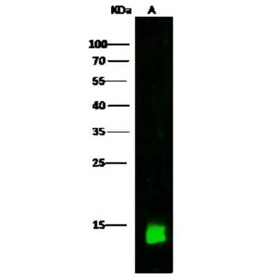 Western Blot: CRABP2 Antibody [NBP2-99740]