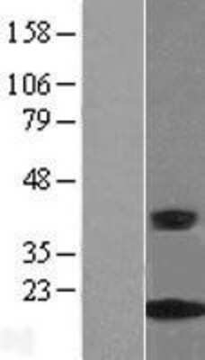 Western Blot: CRABP2 Overexpression Lysate [NBL1-09458]