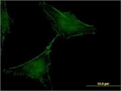 Immunocytochemistry/ Immunofluorescence: CRACC/SLAMF7 Antibody (1B9) [H00057823-M01]