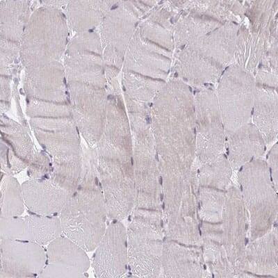 Immunohistochemistry-Paraffin: CRACC/SLAMF7 Antibody [NBP2-37951]