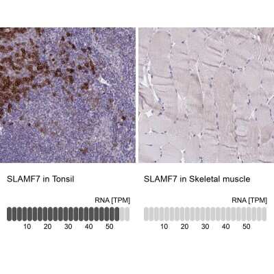 Immunohistochemistry-Paraffin: CRACC/SLAMF7 Antibody [NBP2-37951]