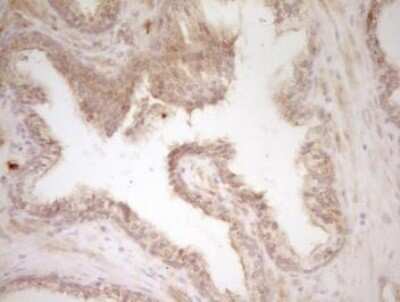 Immunohistochemistry: CRACC/SLAMF7 Antibody (OTI1F1) - Azide and BSA Free [NBP2-72107]
