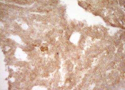 Immunohistochemistry-Paraffin: CRACC/SLAMF7 Antibody (OTI1F1) - Azide and BSA Free [NBP2-72107]