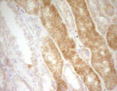 Immunohistochemistry-Paraffin: CRACC/SLAMF7 Antibody (OTI1F1) - Azide and BSA Free [NBP2-72107]