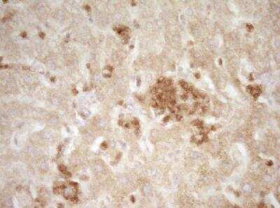 Immunohistochemistry-Paraffin: CRACC/SLAMF7 Antibody (OTI1F1) - Azide and BSA Free [NBP2-72107]