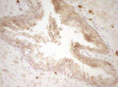 Immunohistochemistry-Paraffin: CRACC/SLAMF7 Antibody (OTI1F1) - Azide and BSA Free [NBP2-72107]