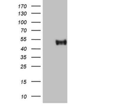 Western Blot: CRACC/SLAMF7 Antibody (OTI1F1)Azide and BSA Free [NBP2-72107]