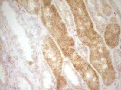 Immunohistochemistry: CRACC/SLAMF7 Antibody (OTI1F1) [NBP2-45868]