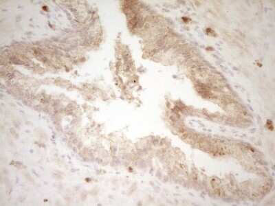 Immunohistochemistry: CRACC/SLAMF7 Antibody (OTI1F1) [NBP2-45868]