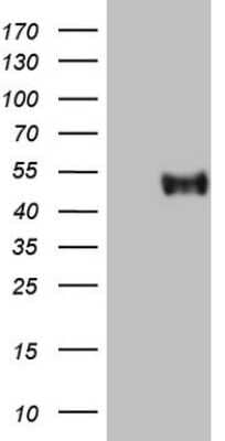 Western Blot: CRACC/SLAMF7 Antibody (OTI1F1) [NBP2-45868]