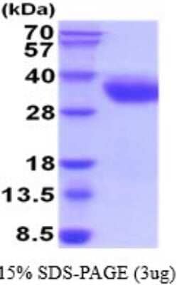 SDS-PAGE: Recombinant Human CRACC/SLAMF7 His Protein [NBP2-52258]