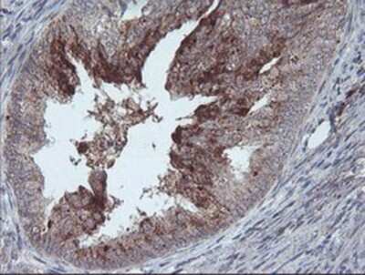 Immunohistochemistry-Paraffin: CRALBP Antibody (OTI1G6) [NBP2-00968]