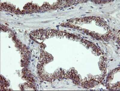 Immunohistochemistry-Paraffin: CRALBP Antibody (OTI1G6) [NBP2-00968]