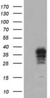 Western Blot: CRALBP Antibody (OTI1G6) [NBP2-00968]