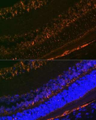 Immunohistochemistry: CRALBP Antibody (2M0G2) [NBP3-16798]