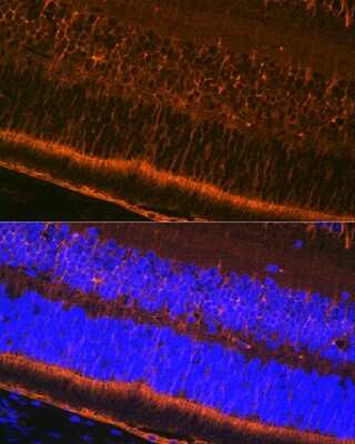 Immunohistochemistry: CRALBP Antibody (2M0G2) [NBP3-16798]