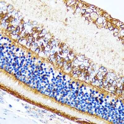 Immunohistochemistry-Paraffin: CRALBP Antibody (2M0G2) [NBP3-16798]