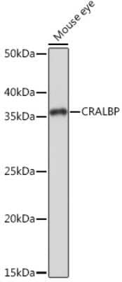 Western Blot: CRALBP Antibody (2M0G2) [NBP3-16798]