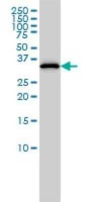 Western Blot: CRALBP Antibody (4H5) [H00006017-M02]