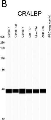 Simple Western: CRALBP Antibody (B2) [NB100-74392]