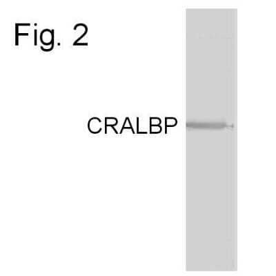 Western Blot: CRALBP Antibody (B2) [NB100-74392]