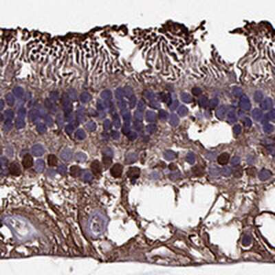 Immunohistochemistry: CRALBP Antibody [NBP2-68644]