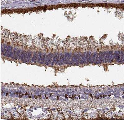 Immunohistochemistry-Paraffin: CRALBP Antibody [NBP2-58065]