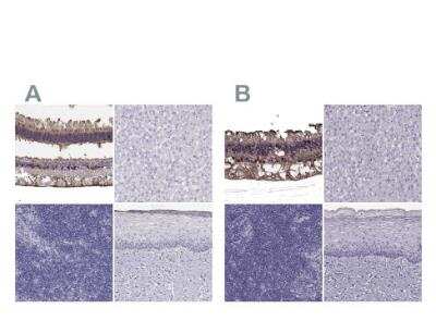 Immunohistochemistry-Paraffin: CRALBP Antibody [NBP2-58065]