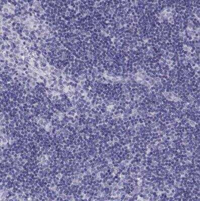 Immunohistochemistry-Paraffin: CRALBP Antibody [NBP2-58065]