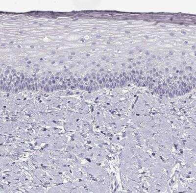Immunohistochemistry-Paraffin: CRALBP Antibody [NBP2-58065]