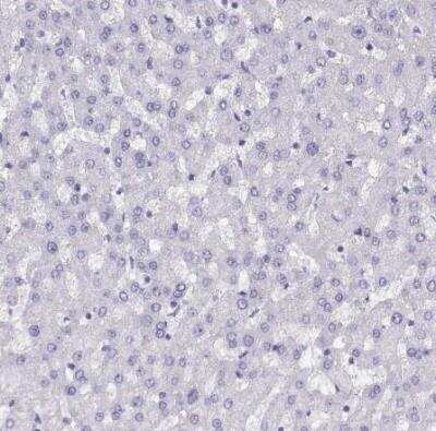 Immunohistochemistry-Paraffin: CRALBP Antibody [NBP2-58065]