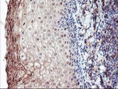 Immunohistochemistry: CRALBP Antibody (OTI1G6) - Azide and BSA Free [NBP2-71275]