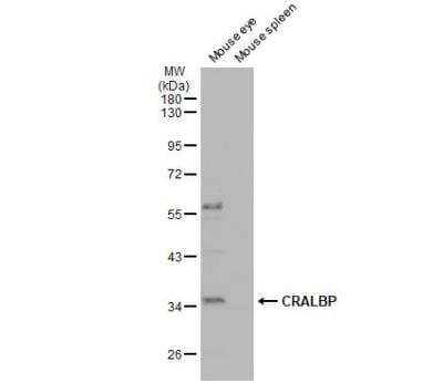 Western Blot: CRALBP Antibody [NBP1-31770]