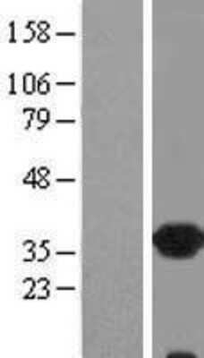 Western Blot: CRALBP Overexpression Lysate [NBL1-15383]