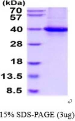 SDS-PAGE: Recombinant Human CRALBP His Protein [NBP2-52382]