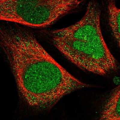 Immunocytochemistry/ Immunofluorescence: CRAMP1L Antibody [NBP1-93589]