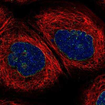 Immunocytochemistry/ Immunofluorescence: CRAT Antibody [NBP1-86614]