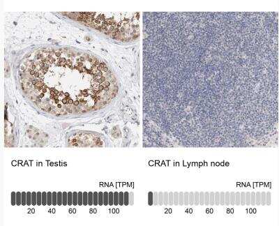 Immunohistochemistry-Paraffin: CRAT Antibody [NBP1-86616]