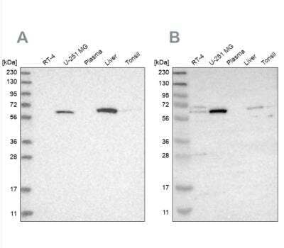 Western Blot: CRAT Antibody [NBP1-86614]