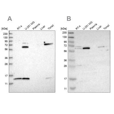 Western Blot: CRAT Antibody [NBP1-86615]