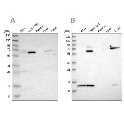 Western Blot: CRAT Antibody [NBP1-86616]