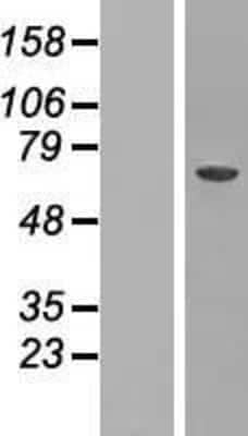 Western Blot: CRAT Overexpression Lysate [NBP2-07922]