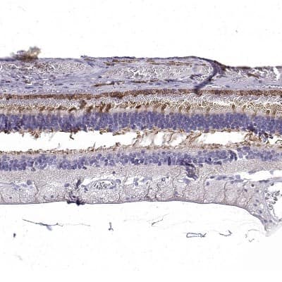 Immunohistochemistry-Paraffin: CRB1 Antibody [NBP2-55734]