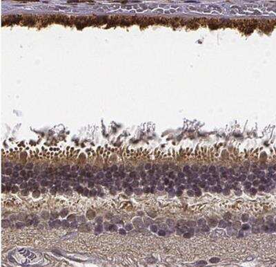 Immunohistochemistry-Paraffin: CRB1 Antibody [NBP2-56113]